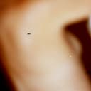 Artwork of Skin